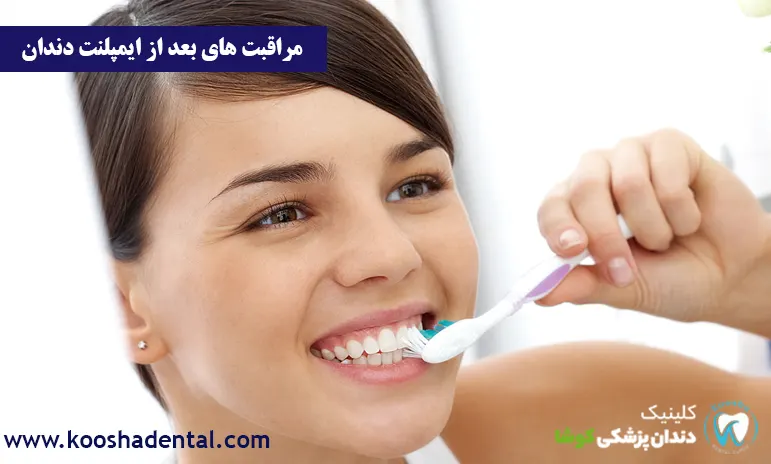 مراقبت های بعد از ایمپلنت دندان